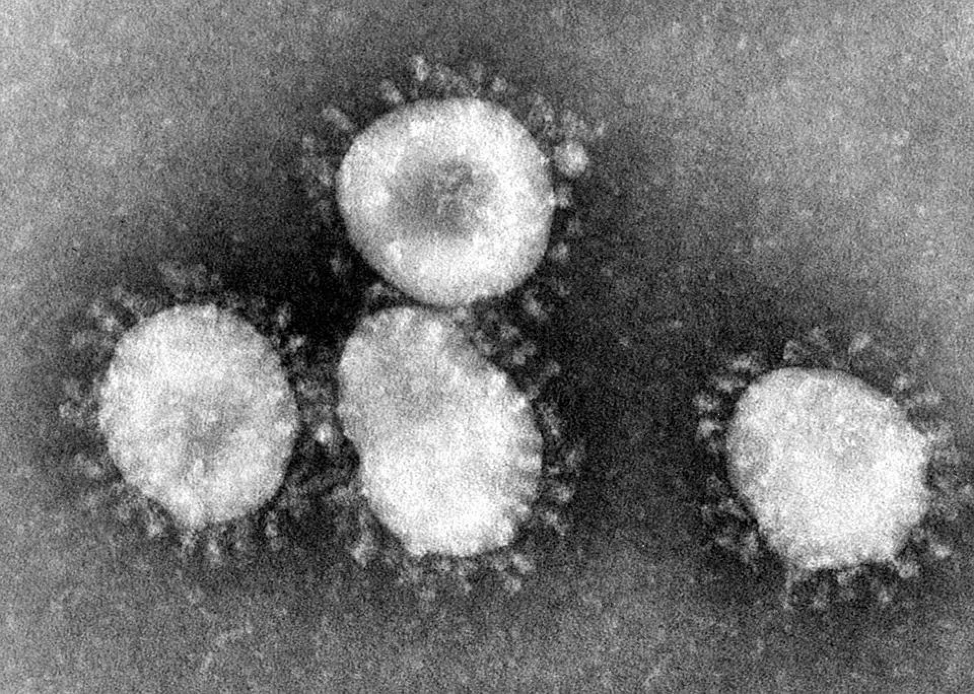 Krakowscy naukowcy zrobili ważny krok ku szybszej diagnozie koronawirusa