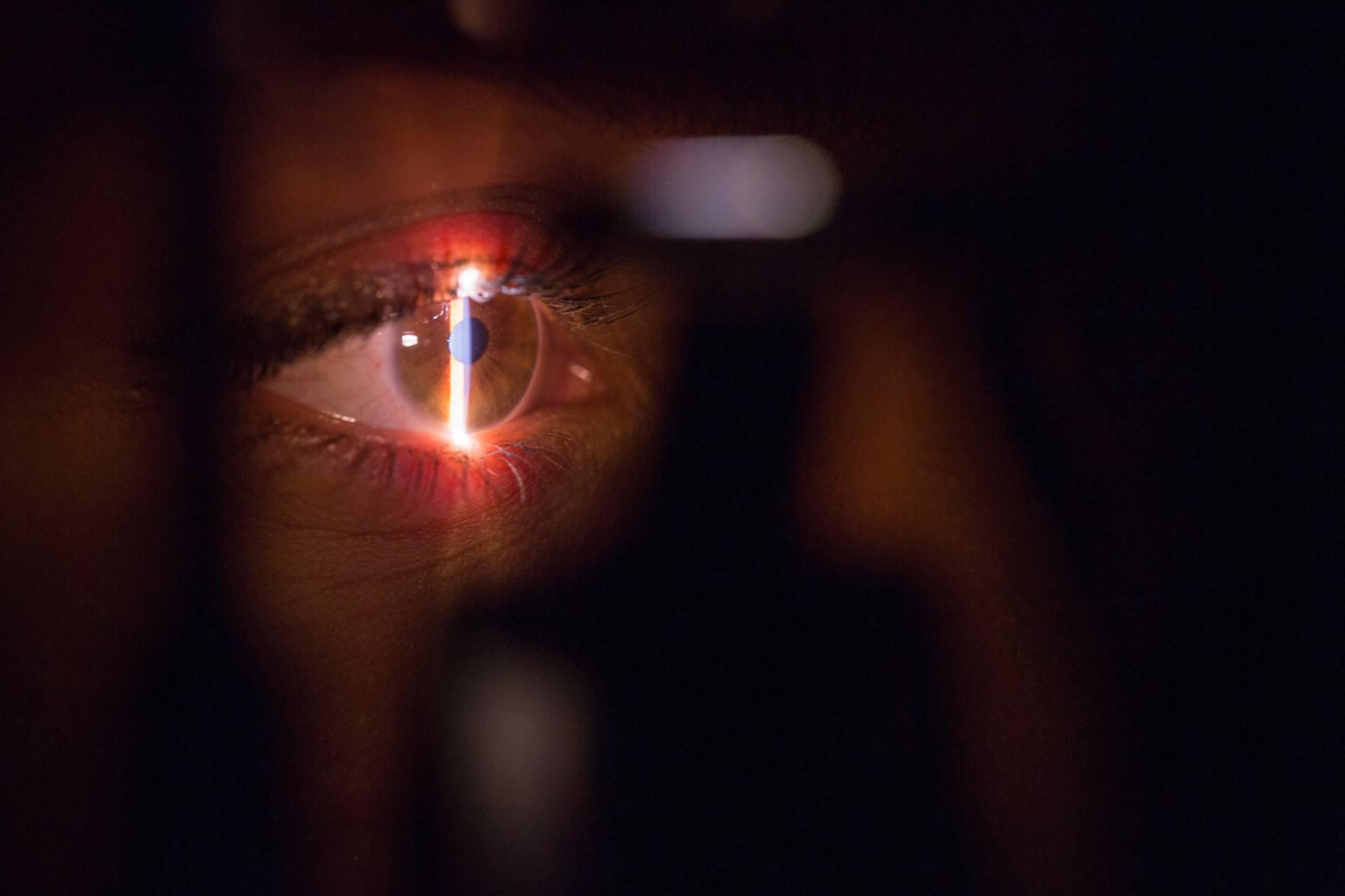 Popularne zabiegi z zakresu laserowej korekcji wzroku – poznaj je bliżej!