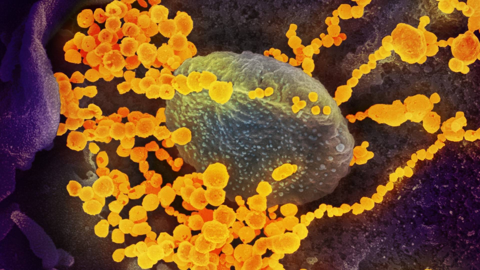 Setki zmian w wirusie wpłyną na pandemię? Najnowsze dane o ofiarach i zakażeniach