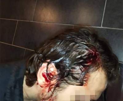 Publikują zdjęcia pobitych przed gejowskim klubem w Krakowie, ohydne komentarze