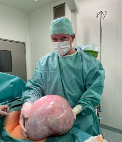 Krakowscy lekarze usunęli guz o wadze 15 kg. Pacjentka myślała, że... przytyła