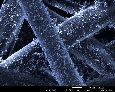 Smog pod mikroskopem. Te zdjęcia robią wrażenie