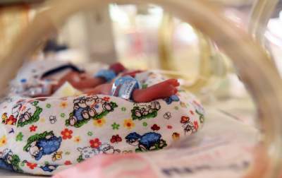 Krakowskie sześcioraczki: raz na kilka miliardów ciąż - zdjęcie 24