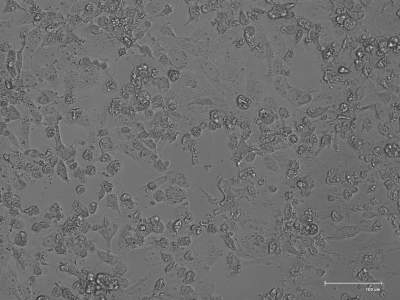 Tak wygląda omikron: wykryto pierwszy przypadek, w Krakowie wirus "w zamknięciu"